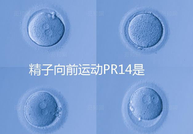 精子向前運(yùn)動(dòng)PR14是否正常聽專家怎么說,當(dāng)心弱精找上門