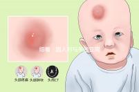 細看：國人對馬來西亞同善醫院試管嬰兒技術的評價