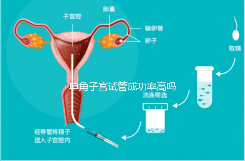 單角子宮試管成功率高嗎？送你5招降低胚胎著床的難度