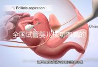 全國試管嬰兒成功率高的醫院排名,內附2023試管費用及成功率參考