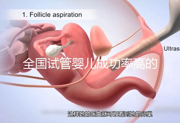 全國試管嬰兒成功率高的醫(yī)院排名,內附2023試管費用及成功率參考