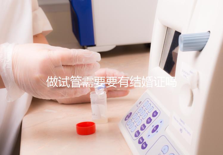 做試管需要要有結(jié)婚證嗎？做試管需要結(jié)婚證