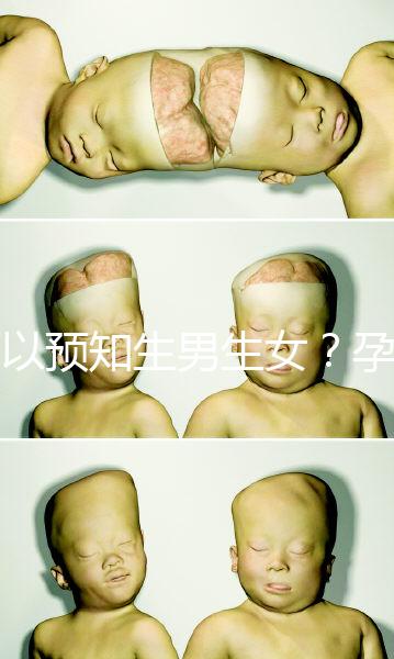 可以預(yù)知生男生女?孕婦夢(mèng)見(jiàn)馬的胎夢(mèng)解讀