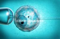 北京試管雙胞胎醫(yī)院排名出爐！西城區(qū)這些機(jī)構(gòu)成功率高