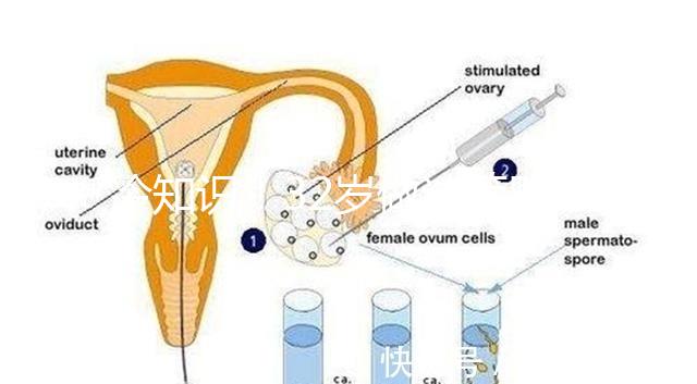 冷知識！32歲做試管嬰兒提升成功率的方法請收藏