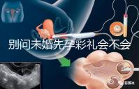 別問未婚先孕彩禮會(huì)不會(huì)少了,一分不給也不無可能