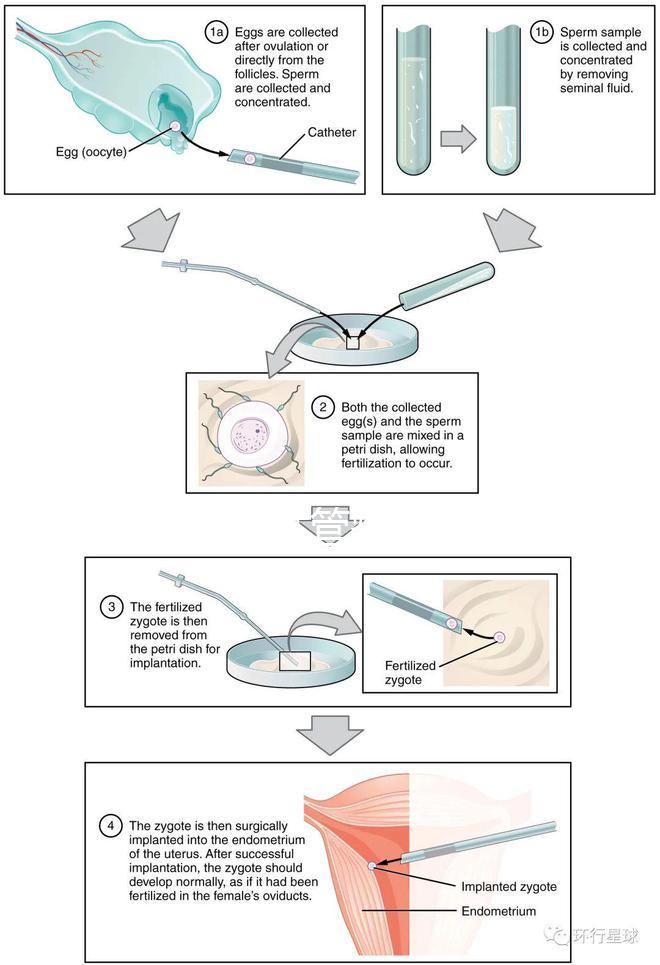 國內首起試管嬰兒案例,法律竟難以給患者維權
