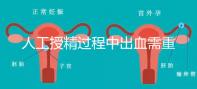 人工授精過程中出血需重視！這3種情況會影響成功率