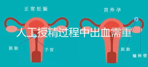 人工授精過(guò)程中出血需重視！這3種情況會(huì)影響成功率