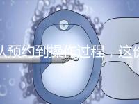 從預約到操作過程,這份tct檢查流程攻略請查收