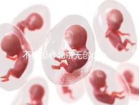 不要擔(dān)心北京無創(chuàng)dna一次多少錢,2024年北京婦幼可以報銷