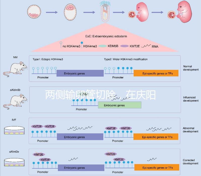 兩側(cè)輸卵管切除,在慶陽有醫(yī)院能做試管嬰兒嗎?