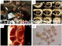 九江市婦幼保健院試管成功率高、費用低?生殖醫生揭開真相