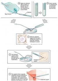 成都華西二院無創dna價格來了，2024想造哪里能免費做看這
