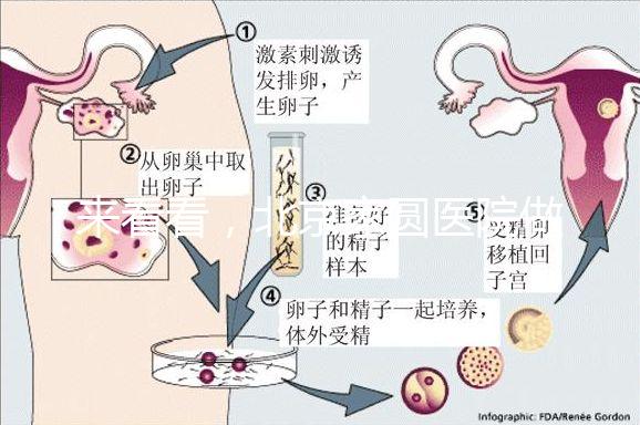 來看看，北京家圓醫院做三代試管費用總共多少？