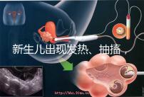 新生兒出現(xiàn)發(fā)熱、抽搐，很可能是胎毒的表現(xiàn)