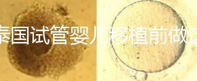 泰國試管嬰兒移植前做這3件事能提高成功率，不然會后悔！
