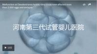 河南第三代試管嬰兒醫(yī)院整理,成功率、費用全在這