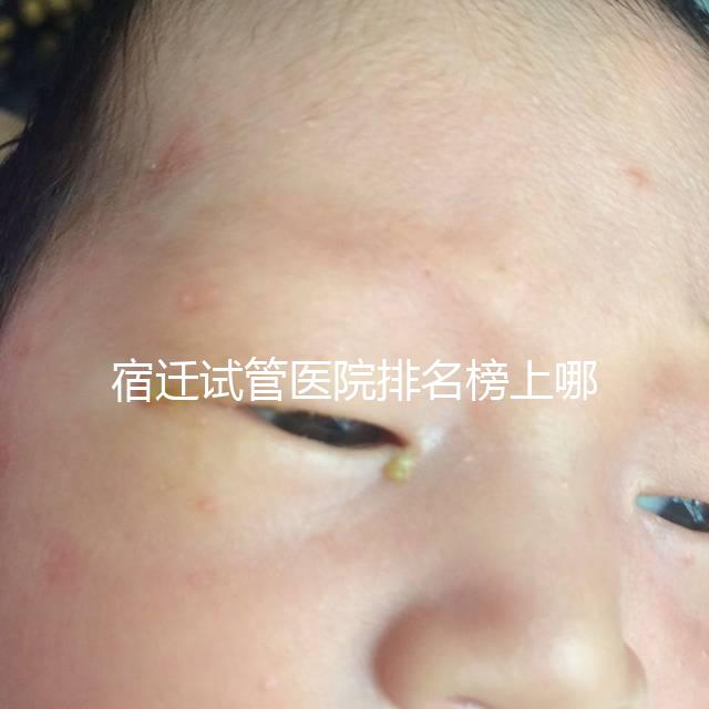 宿遷試管醫(yī)院排名榜上哪家好，不造助孕成功率和費(fèi)用別亂選