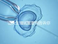 山大生殖試管案例告訴你,歷經(jīng)3個月后懷孕辛酸史