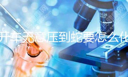 開車無意壓到蛇要怎么化解進(jìn)來瞧，要不要報警一目了然