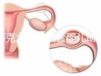 巧克力囊腫試管嬰兒助孕應(yīng)先治療?網(wǎng)友看法均有差異