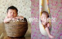 胎兒頭位、橫位、臀位區(qū)別大,5個方面教你分辨