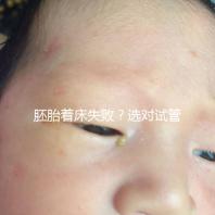 胚胎著床失敗?選對試管嬰兒醫(yī)生很重要