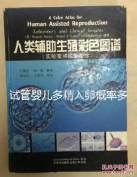 試管嬰兒多精入卵概率多少難說(shuō),比正常配對(duì)低別瞎操心