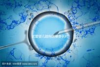 試管嬰兒建檔需要多長時間進來瞧,內(nèi)含詳細流程供參考