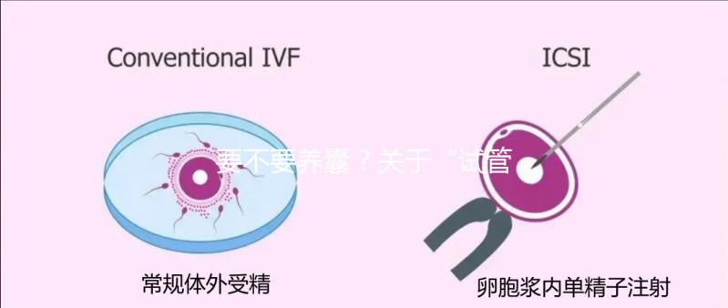 要不要養囊？關于“試管養囊”你是否會有很多問號？