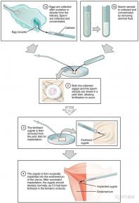 貴陽未婚子女戶口如何向婦女介紹，附2024年結算流程