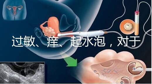 過敏、癢、起水泡，對于三伏貼的副作用你需知道該怎么辦