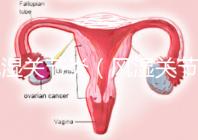 風(fēng)濕關(guān)節(jié)炎(風(fēng)濕關(guān)節(jié)炎的癥狀有哪些)